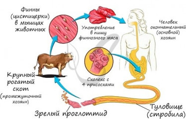 памятка для населения Финноз (цистицеркоз) - фото - 1